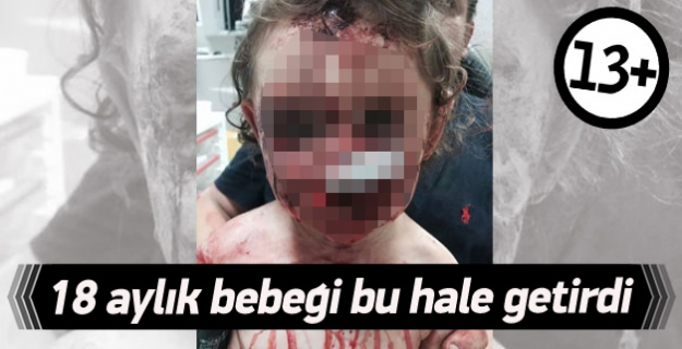 18 aylık bebeği bu hale getirdi