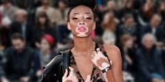 Hastalığını Avantaja Çevirdi: Winnie Harlow