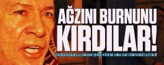 O rezil herifin ağzını burnunu kırdılar!